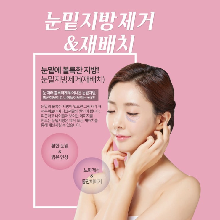 전주눈밑지방제거 , 재배치 로 눈밑을 환하게!! <b>메이크</b>유성형외과