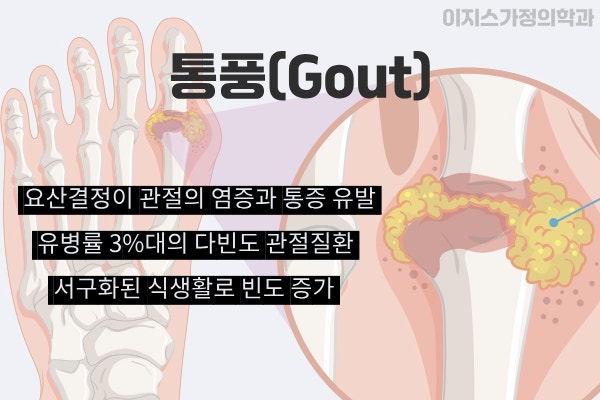 통풍에서의 요산관리, 자이로릭vs페브릭