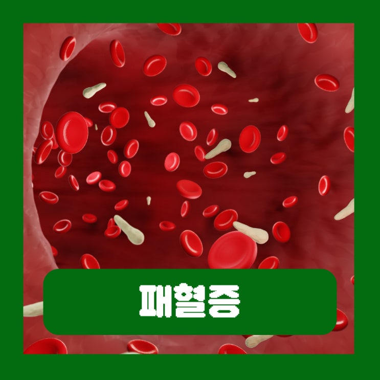  패혈증 뜻 쇼크 사망률 치사율 증상 원인 치료