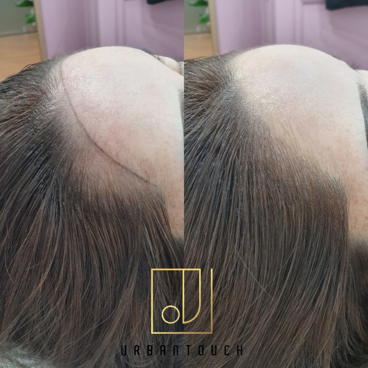  구래동 헤어라인 잘하는곳 /구래동 헤어라인 문신 잘하는곳 추천