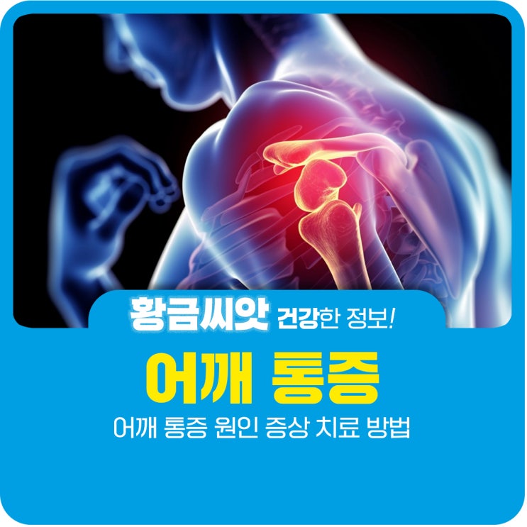  어깨 통증 원인 증상 치료 방법