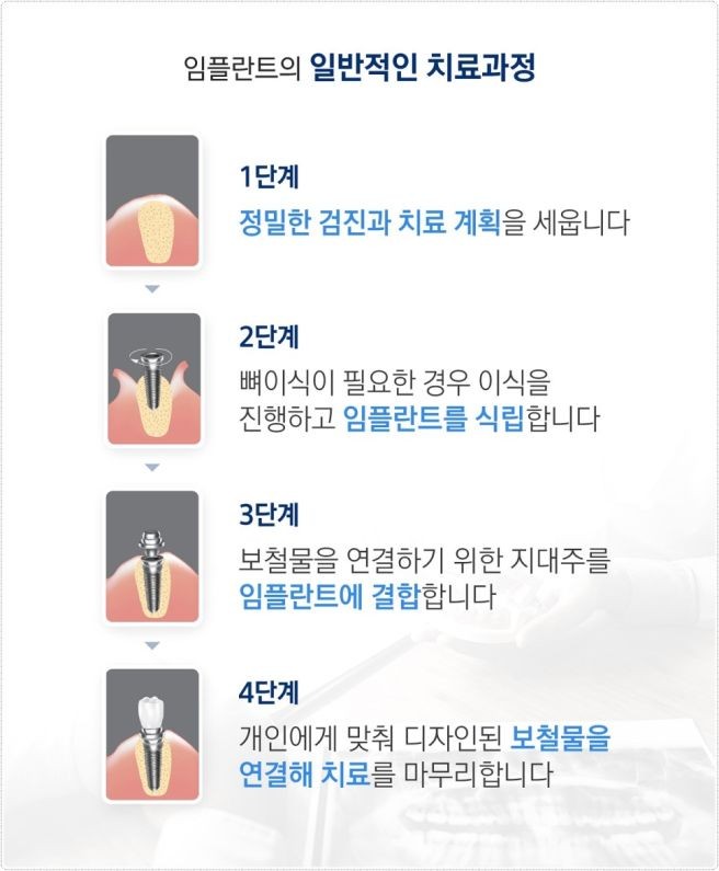   치과 임플란트 수술시 주의해야 할 사항과 그 비용은 대략 얼마?