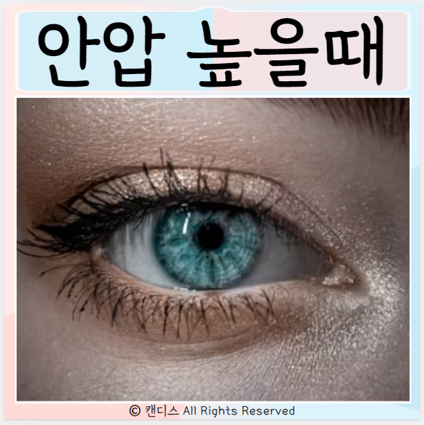  안압 정상수치 높을때 원인 증상 낮추는법