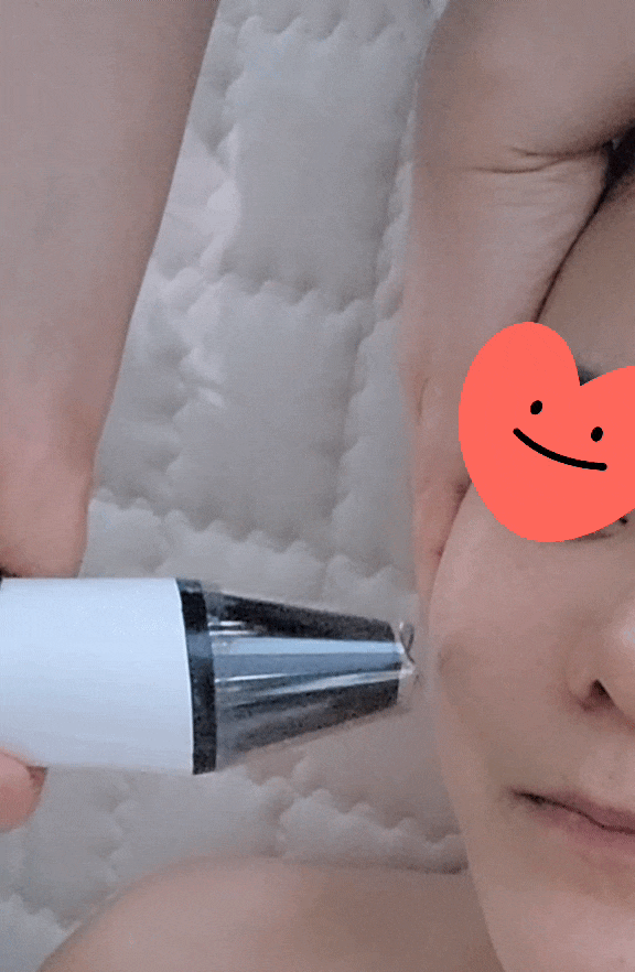  대구칠곡피부관리 아일뷰티 모공관리로 쫀쫀한 피부