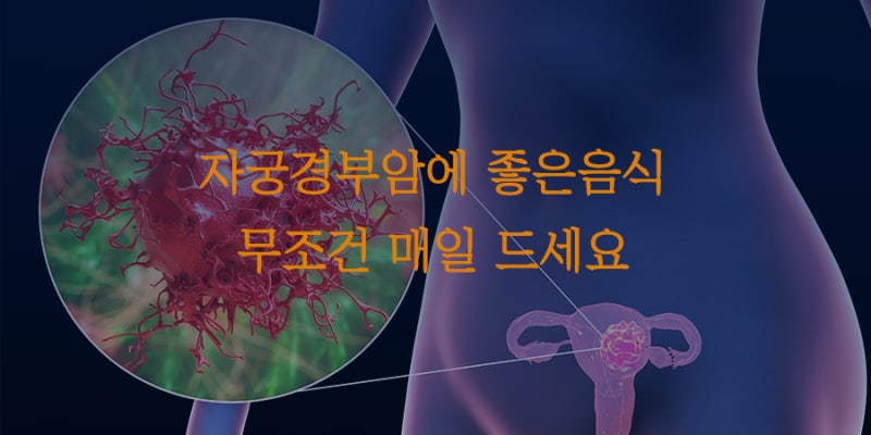자궁경부암에 좋은 음식 관리를 위해 필요한 것은?