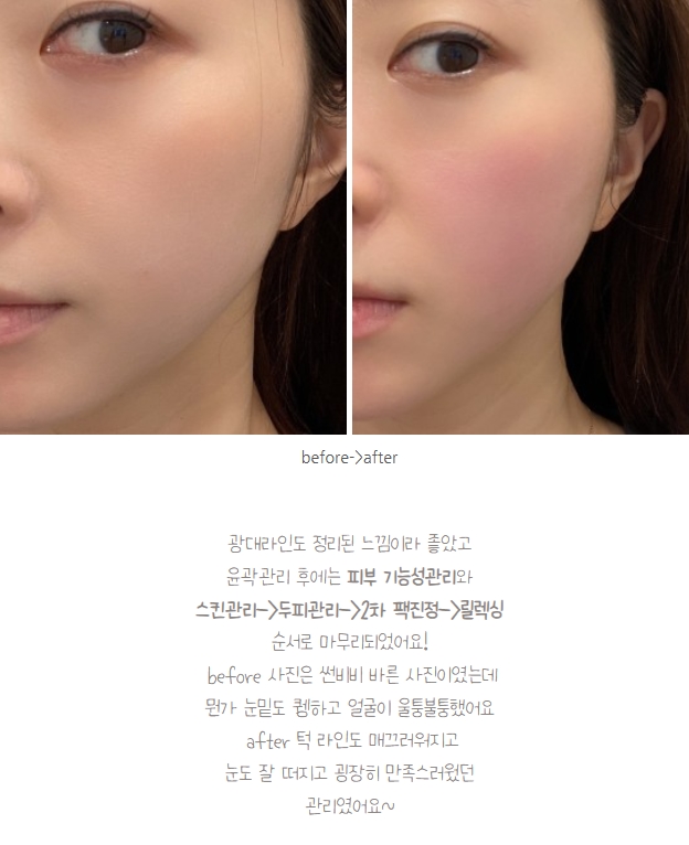  부산서면 달리아스파 피부관리 재방문 리뷰(by옐랑둥이)