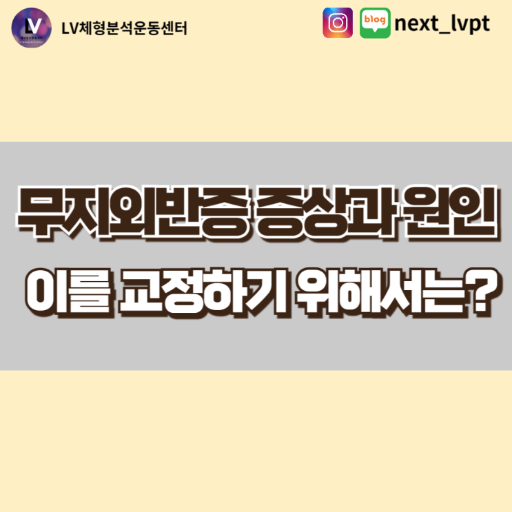  무지외반증 증상과 원인, 이를 교정하기 위해서는? (부산 무지외반증)