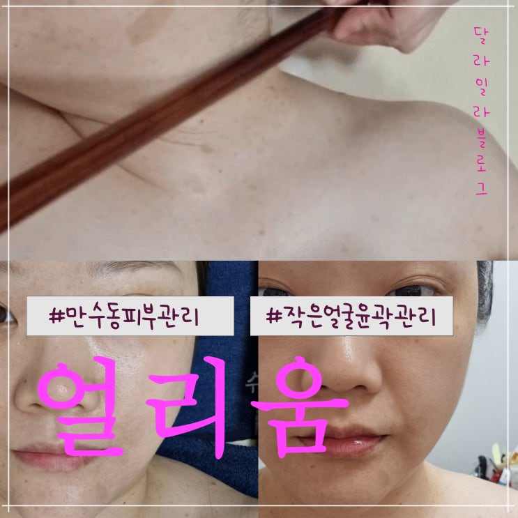  만수동피부관리 잘하는곳 두번째 방문하는 얼리움 작은얼굴 윤곽관리 뱀부테라피 후기