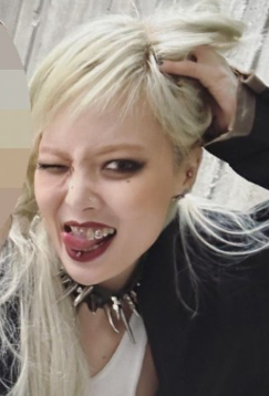  현아 투스젬 가격 뜻 투스잼 제거 부작용은?