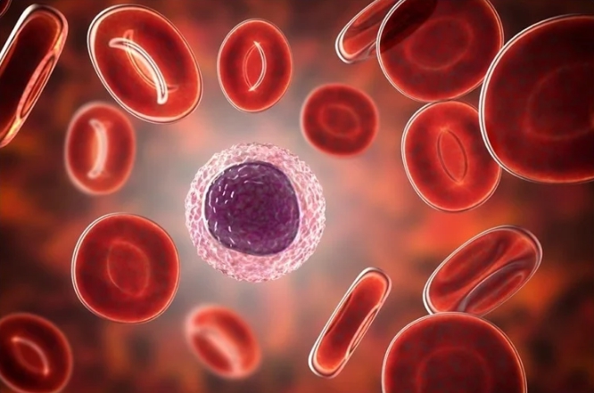  Lymphocyte 수치와 림프구 보험 기준