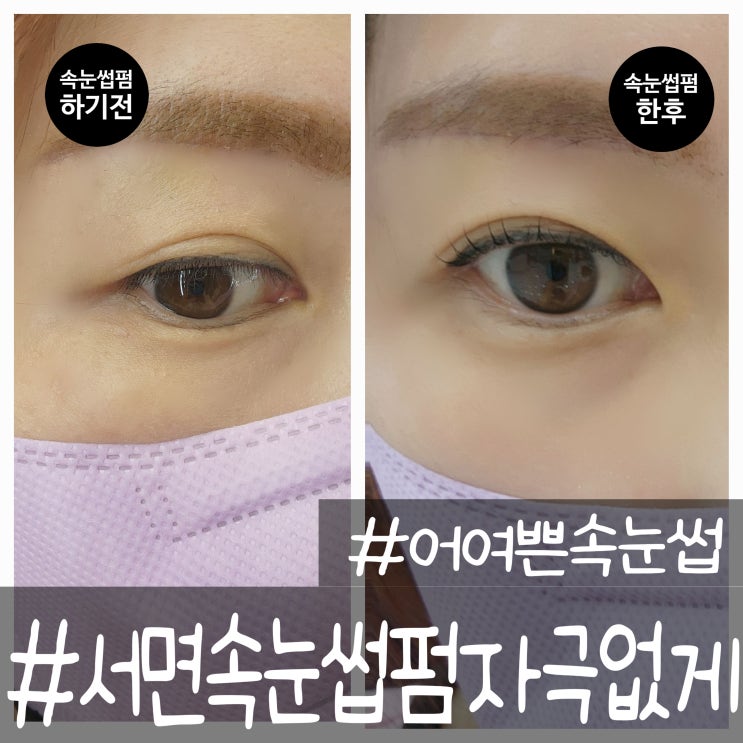  서면속눈썹펌 노글루 블랙틴팅 잘하는 어여쁜속눈썹