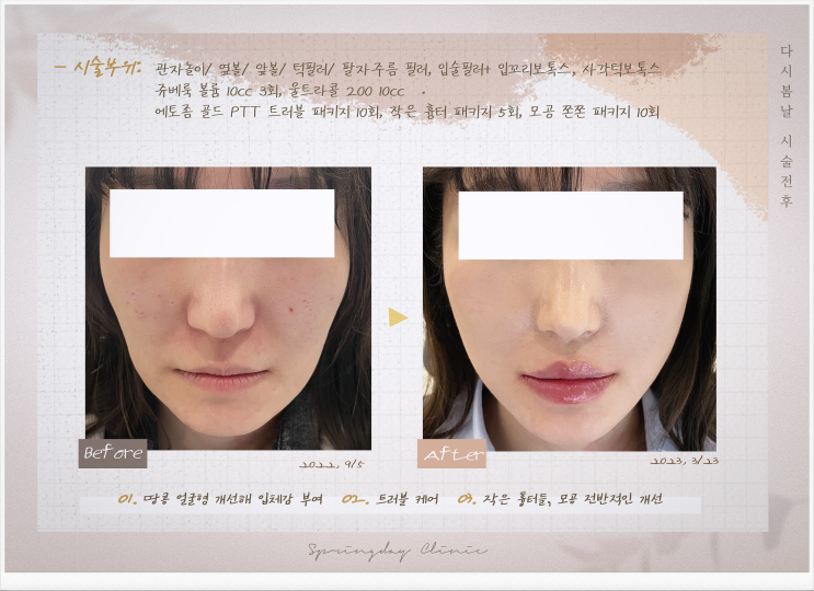  여의도역피부과 리프팅부터 색소까지 맞춤형 접근