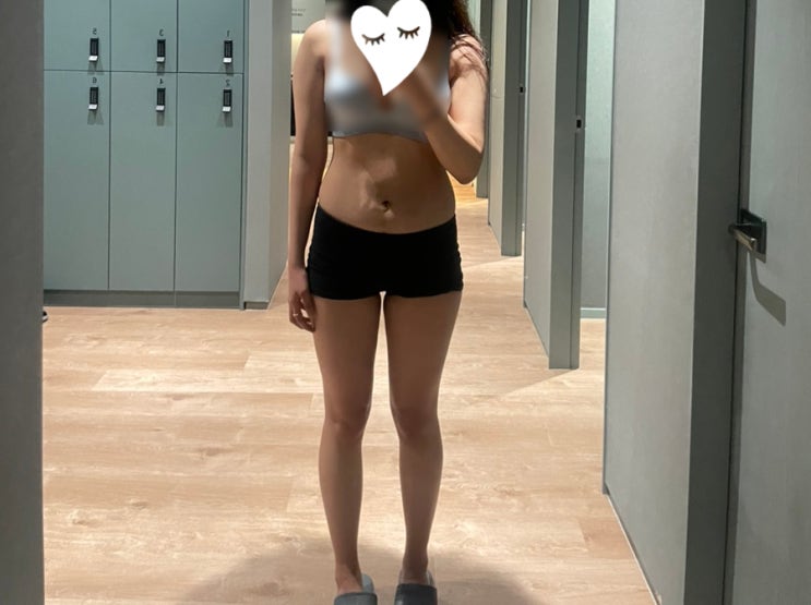  상상만큼 쉬운 다이어트 부산 다이어트 의원 내돈내산 후기 : 지방분해 4회차 후기