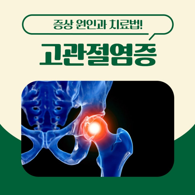 고관절 염증 증상 원인 치료방법 무엇일까?