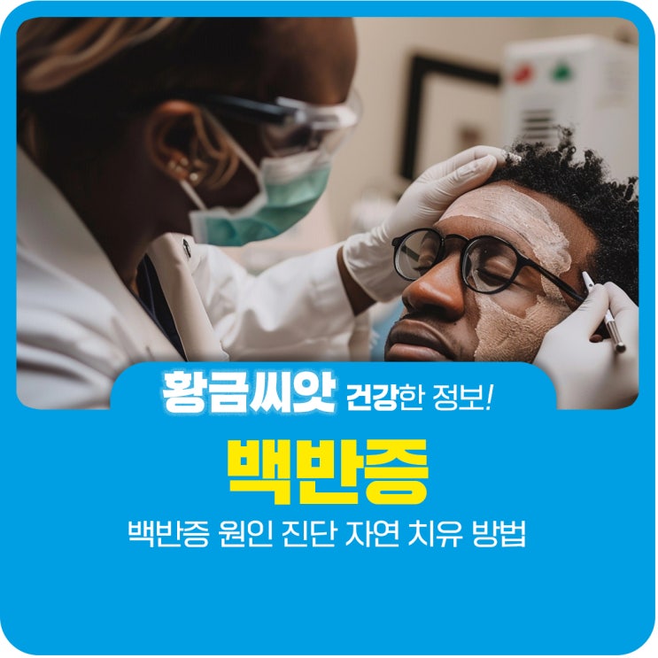 백반증 원인 진단 자연 치유 방법