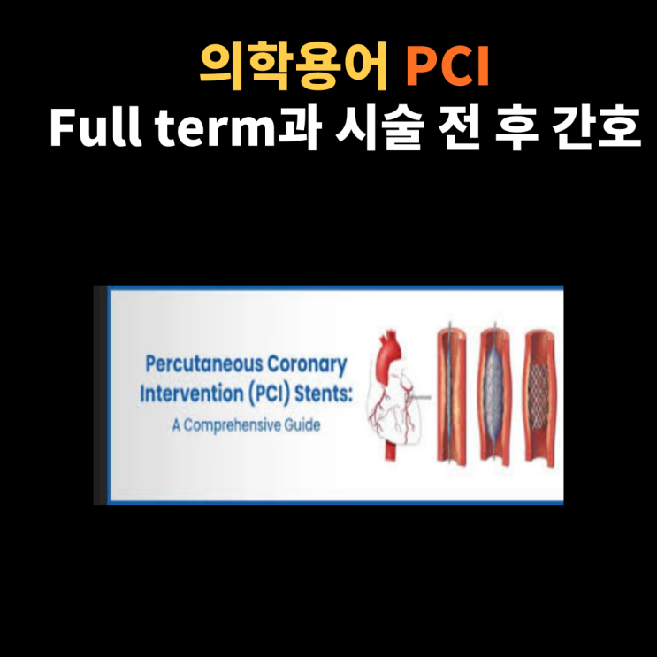  의학용어 PCI의 full term과 경피적 관상동맥 중재술을 시행할 때와 시술 전 후 관리에 대해서