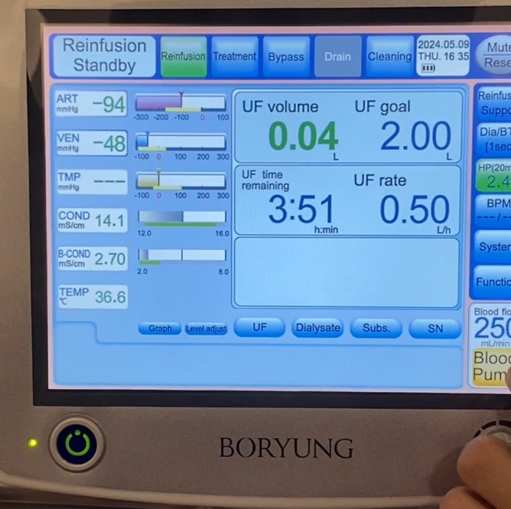  hemodialysis therapy system 보령 NCU-18 NIPRO 혈액 투석기계 reinfusion 하는 방법