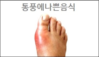  통풍에나쁜음식