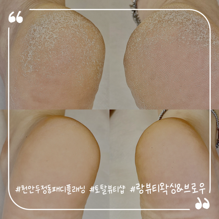  천안발각질관리 발각질케어 두정동패디플래닝 랑뷰티왁싱&브로우