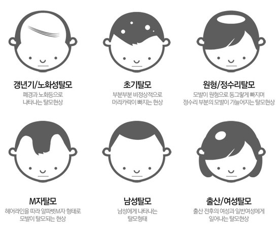  부산두피문신 하려면 이정도는 알아야 되지 않을까 ?