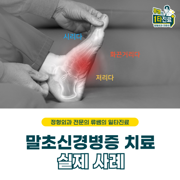  발끝이 저리고 시려요/말초신경병증 실제치료/당뇨병성(의사작성)