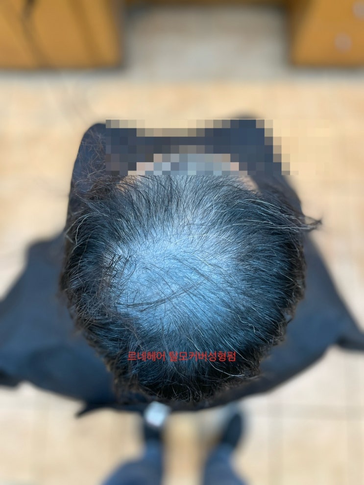  후회중이신가요? 탈모커버펌으로 단점을장점으로만들어드립니다!  부산사상구르네시떼6층 사상홈플러스7층위치