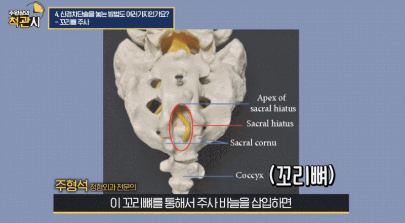 허리디스크꼬리뼈주사? 이 글 하나로 총정리합니다