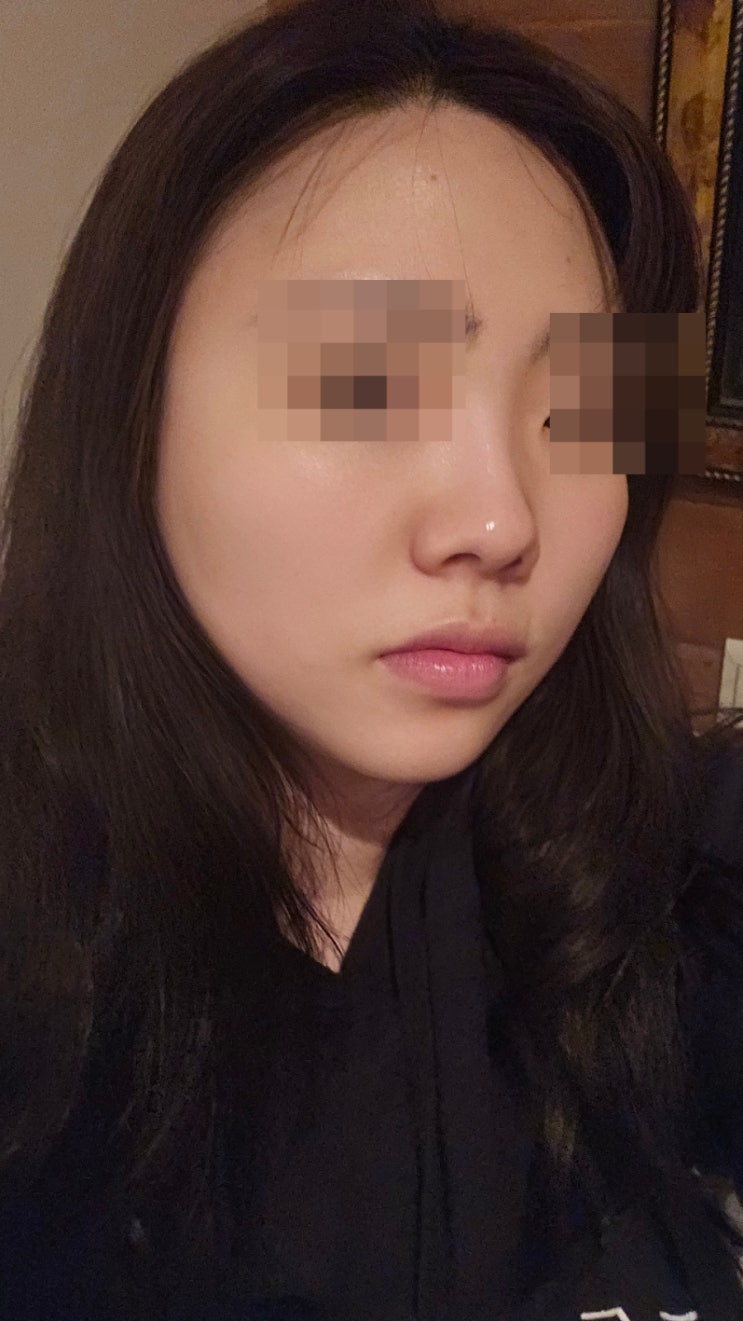  공덕피부관리 율뷰티앤힐링 : 효과는 당연한거고 역에 바로 있어서 접근성 너무 좋아요