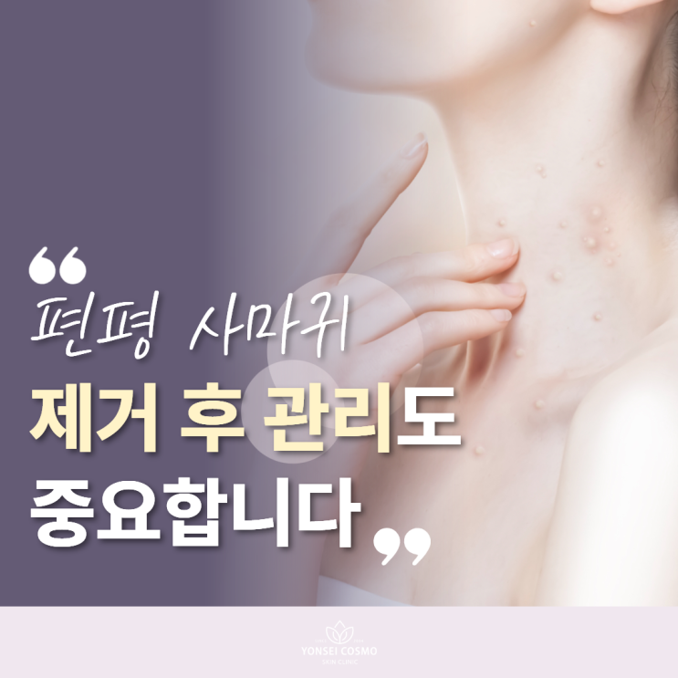  하안동피부과 편평 사마귀 제거 후 관리도 중요합니다