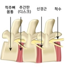  강아지 경추디스크 & 추간판 탈출증(IVDD) 원인, 증상, 엑스레이 비용, 약물치료, 관리법