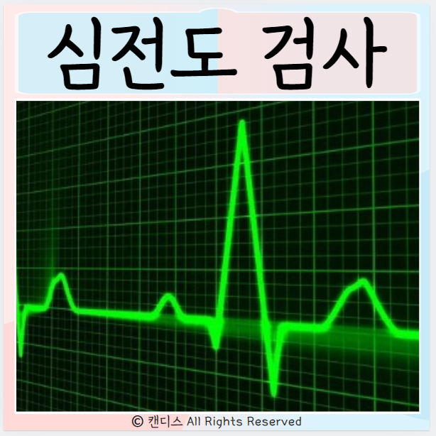  심전도 검사 방법 홀터검사 시간 종류