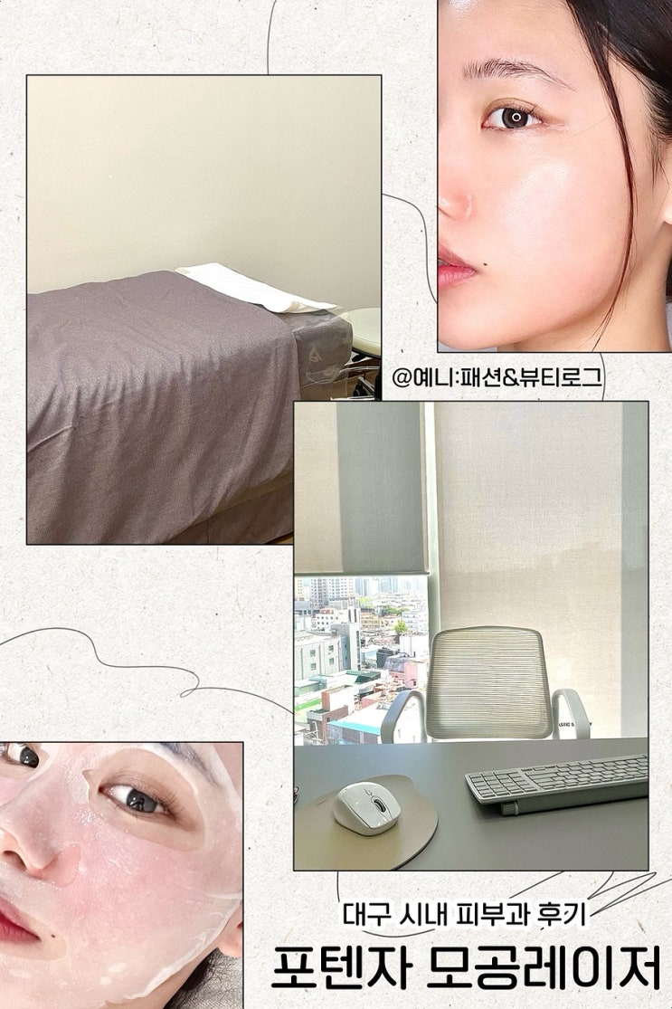  대구 시내 피부과 추천 포텐자 모공레이저 후기