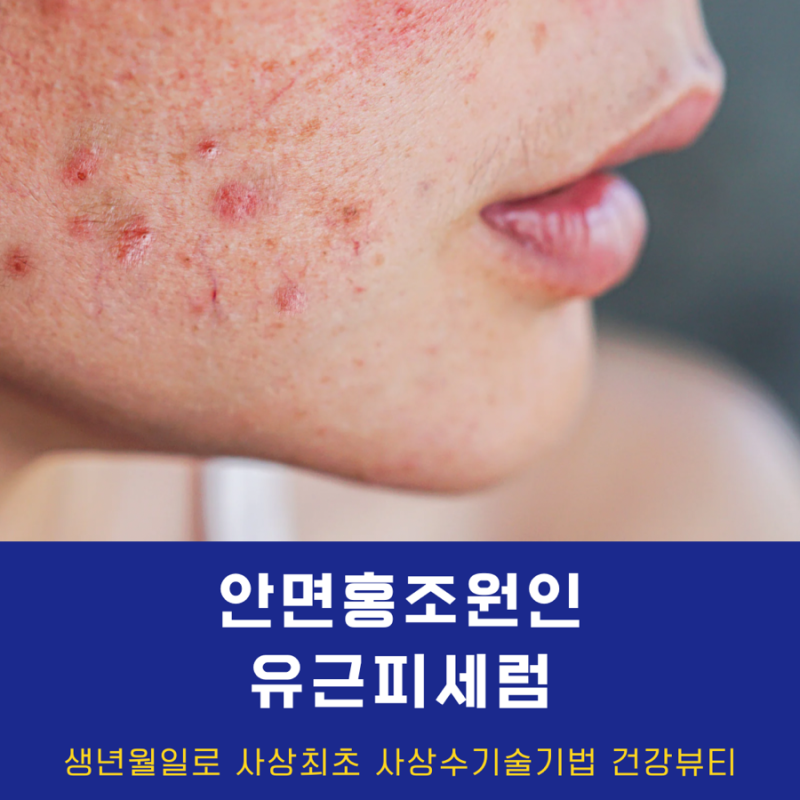 문제성 홍조 때문에 지수는 추천 제품 대신 약국의 홍조크림을 선택했다.