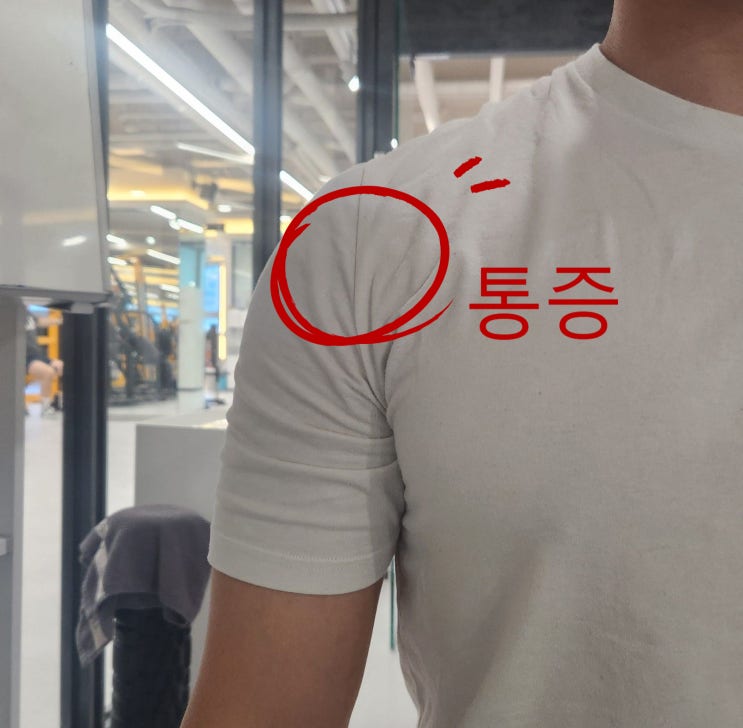  냉정 헬스, 앞으로 튀어나온 어깨는 전방 활주?
