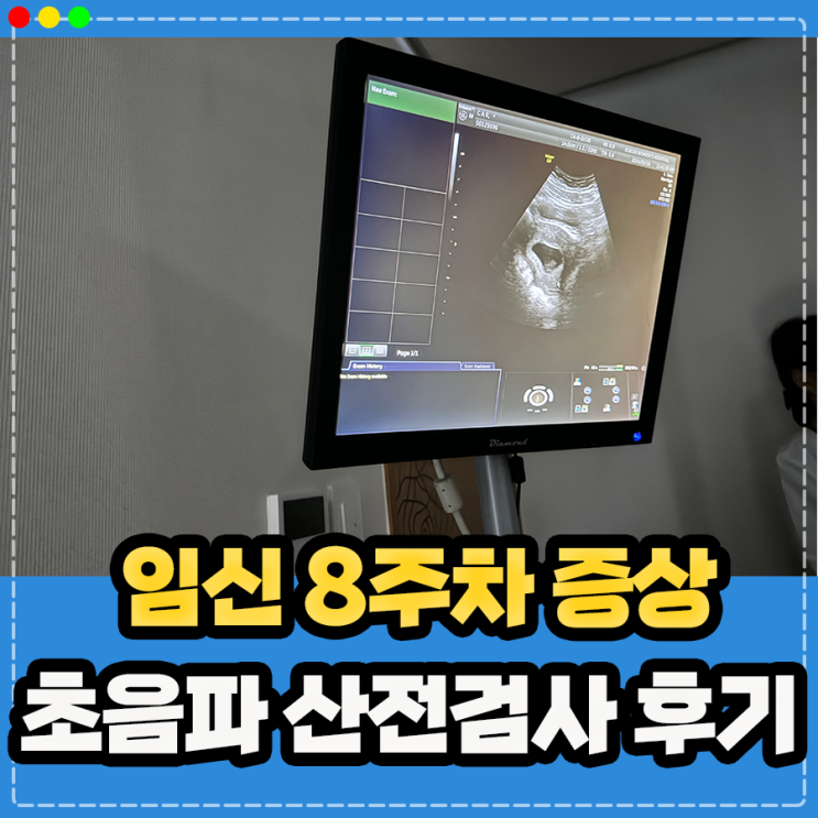  임산부 산전검사 보건소 지원 추가 비용, 임신 8주차 증상 초음파 결과