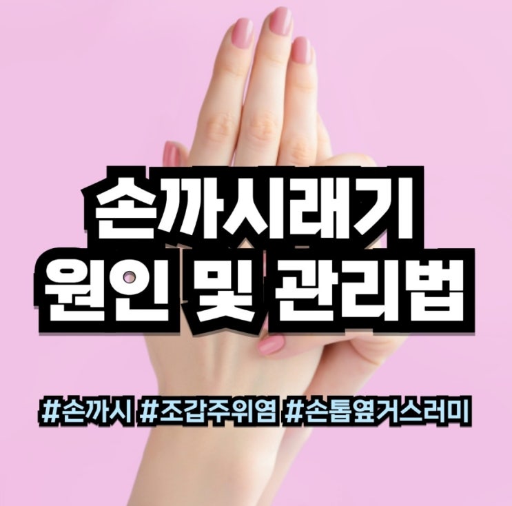  손 까시래기 손톱 옆 거스러미 조갑주위염 원인 및 관리법