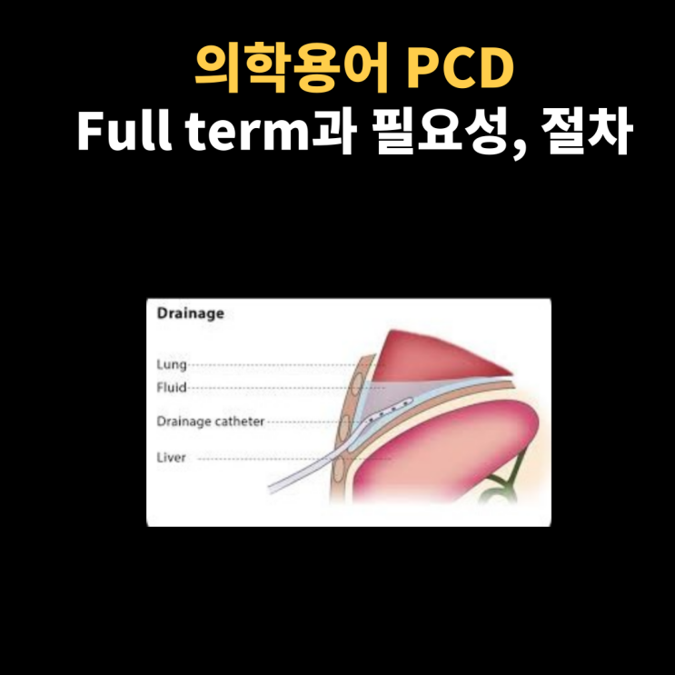  의학용어 PCD 뜻과 무엇인지, 왜 시행하는지, 준비사항에 대해 알아봐요~