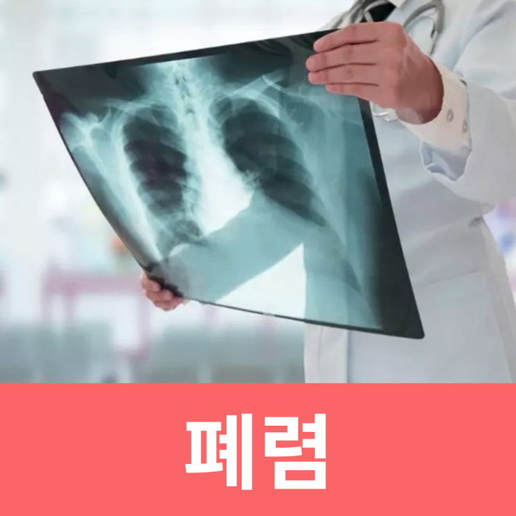  성인 폐렴 초기증상 원인 간질성 진균성 급성 폐렴