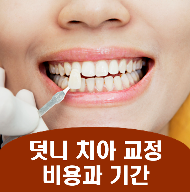 치과 덧니 치아 교정 비용과 기간, 치아교정 하지마라 이유는?