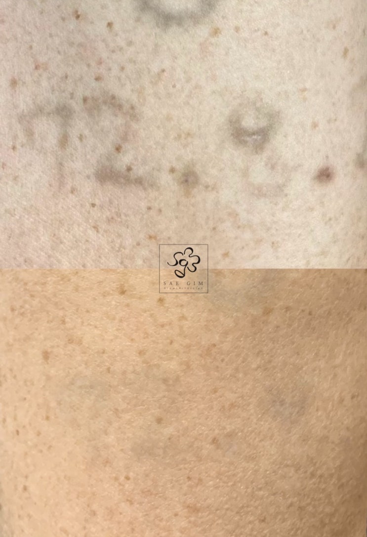  문신할까 말까 고민 중이라면?
