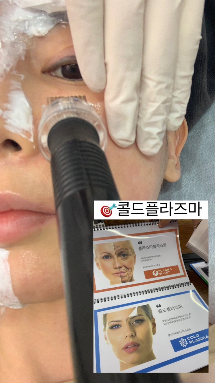  콜드플라즈마 mts 피부결개선 좁쌀여드름 사당피부관리 드가비