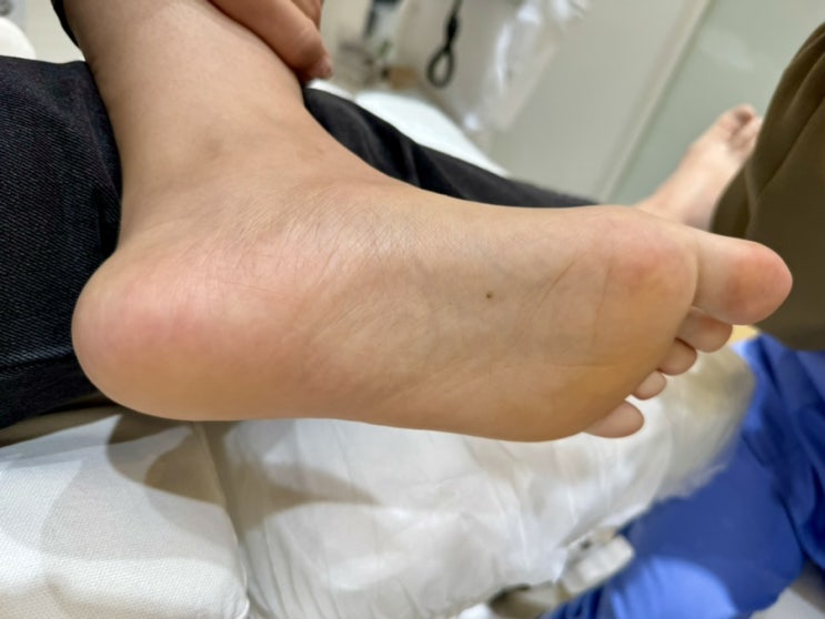  여름맞이 발관리 종로 광화문 각질관리 전문 [레푸스 종로점] 발각질 케어 후기