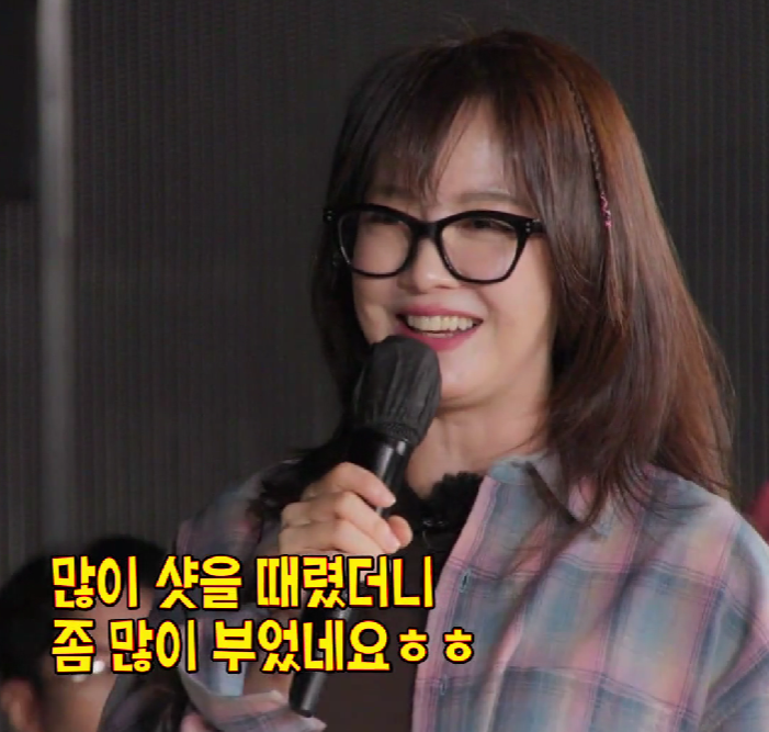  송지효 레이저 600샷 시술 이름 가격 (+300만)