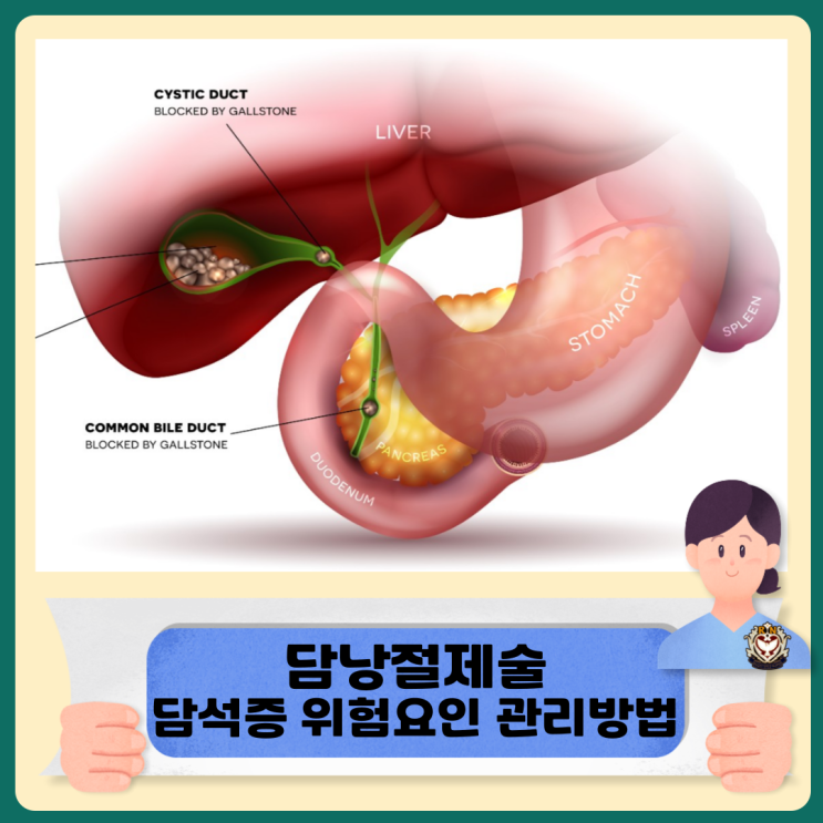  담낭절제술 음식 콜레스테롤 담석증 위험요인과 관리방법