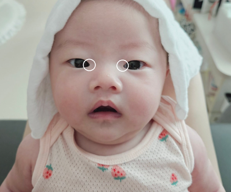  신생아 눈물 눈물샘 마사지 눈곱 끼임