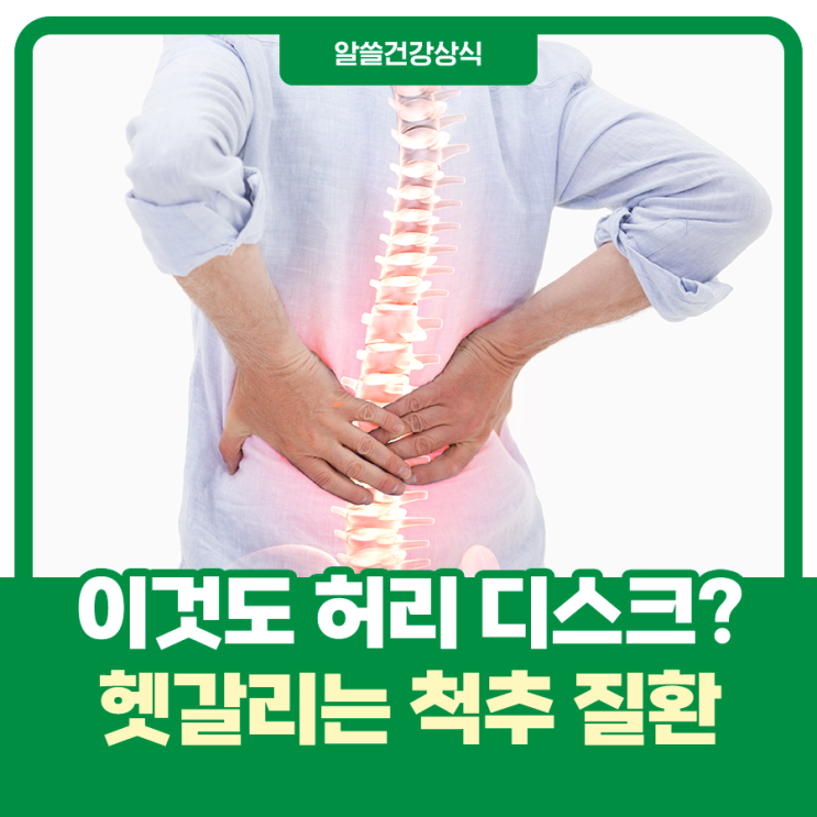  이것도 허리디스크일까? 헷갈리는 척추질환 알아보기!