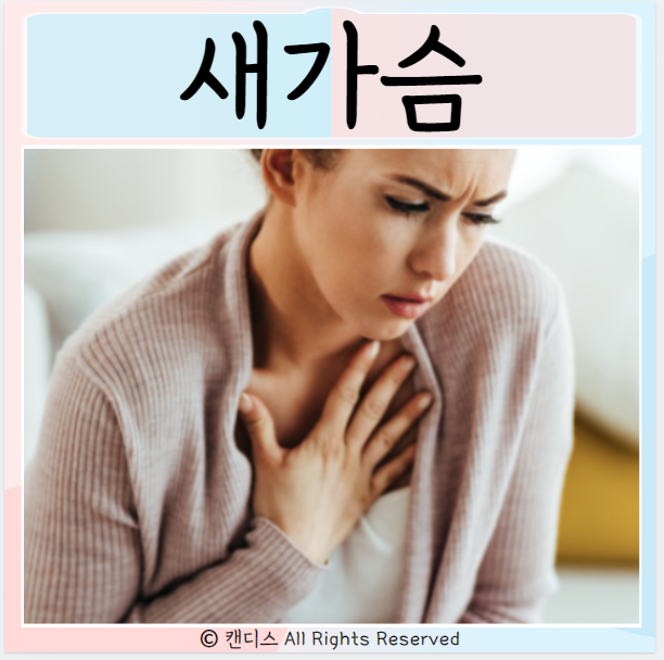  새가슴 원인 오목가슴 증상 치료
