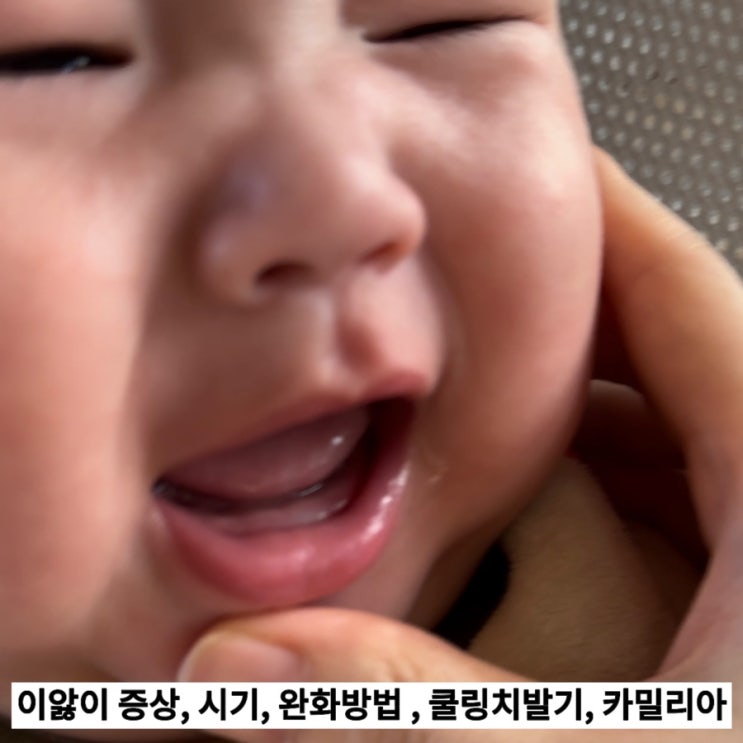 이앓이 증상, 시기, 완화방법 , 쿨링치발기, 카밀리아