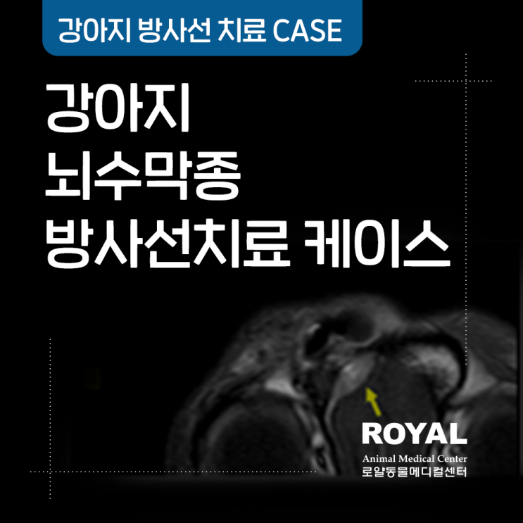 뇌수막종 방사선 치료 케이스_<b>박철</b> 치과원장·줄기세포치료센터장
