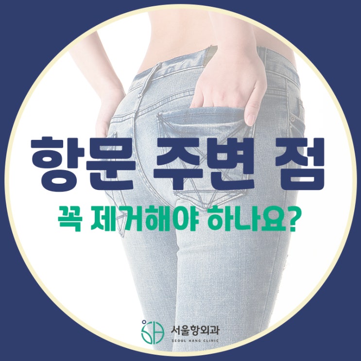  항문 주변 점은 어디서 제거해야 할까?